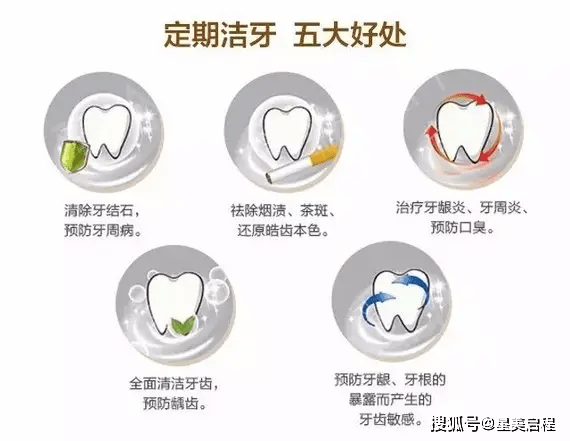 洗牙到底好不好<strong></p>
<p>洗币</strong>？为什么要洗牙？洗牙要注意什么？