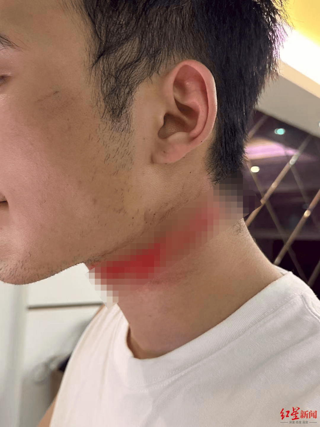 男主播骑车载女友回家被路边掉落网线勒伤脖子<strong></p>
<p>美股</strong>，索赔3万陷僵局 律师解读该谁赔