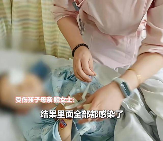 江西一5岁男孩在幼儿园被戳伤致左眼失明<strong></p>
<p>炒美股违法</strong>，家长称老师用猪油涂抹试图消肿