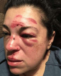 美国一女子散步时因路不平被绊倒脑损伤<strong></p>
<p>小米股票</strong>，市政府愿赔750万美元